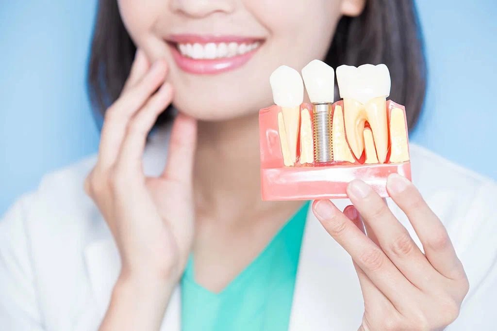 Maquette pédagogique montrant un implant dentaire posé dans l’os