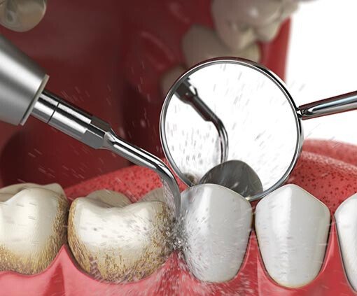 composite-esthetique-resultat.jpg