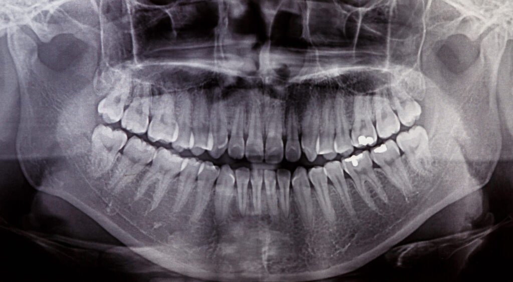 radiologie