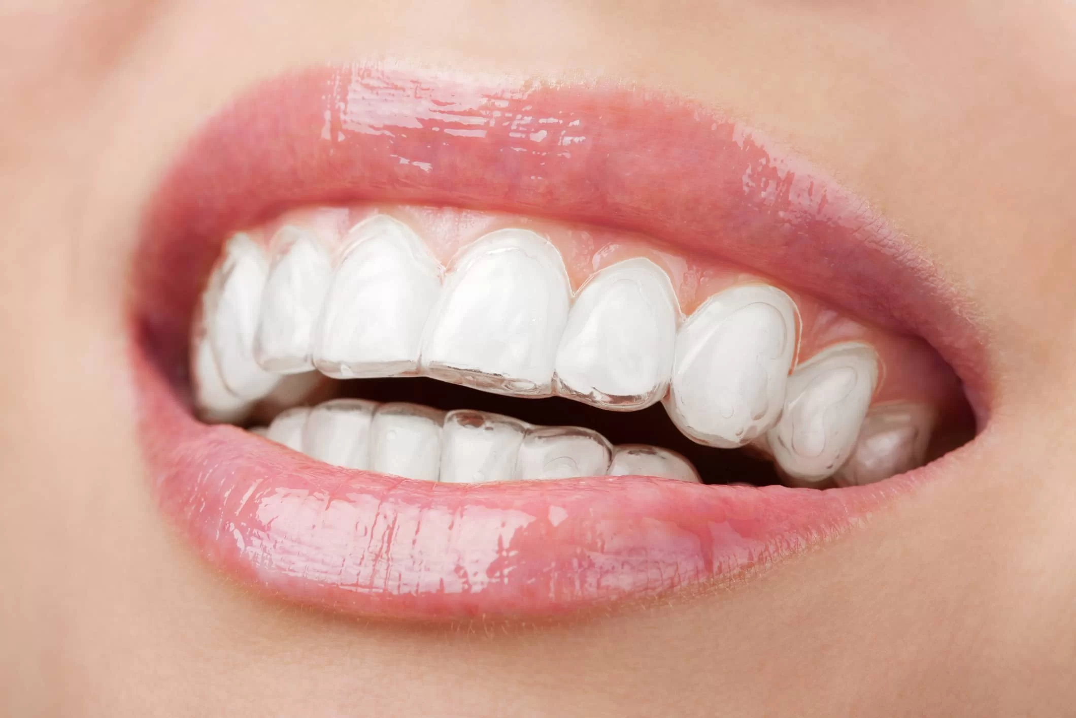 Digital Smile Design