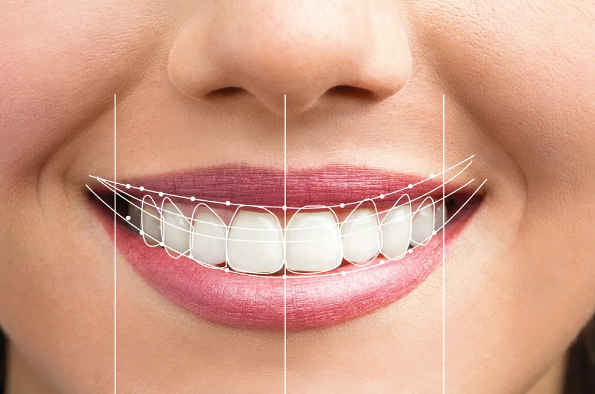 Digital Smile Design