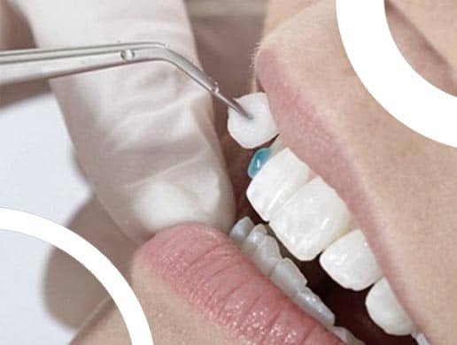 composite-esthetique-resultat.jpg