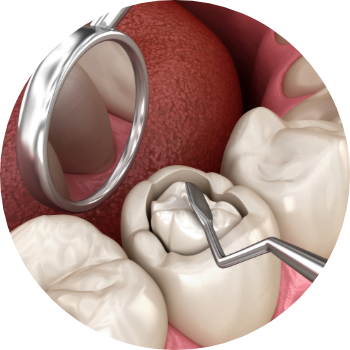 composite-esthetique-resultat.jpg